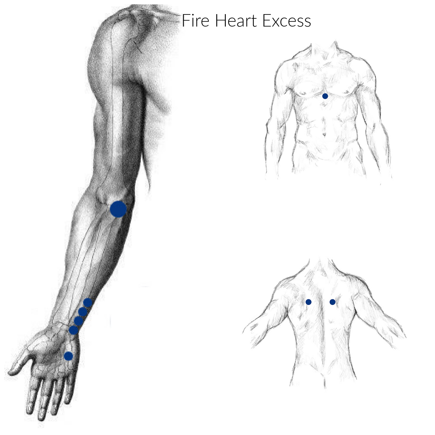 Fire Heart Excess Acupressure Points