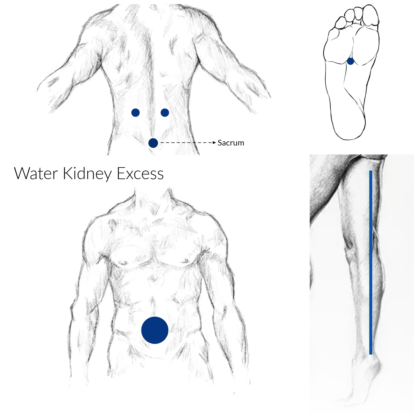 Water Kidney Excess Acupressure Points