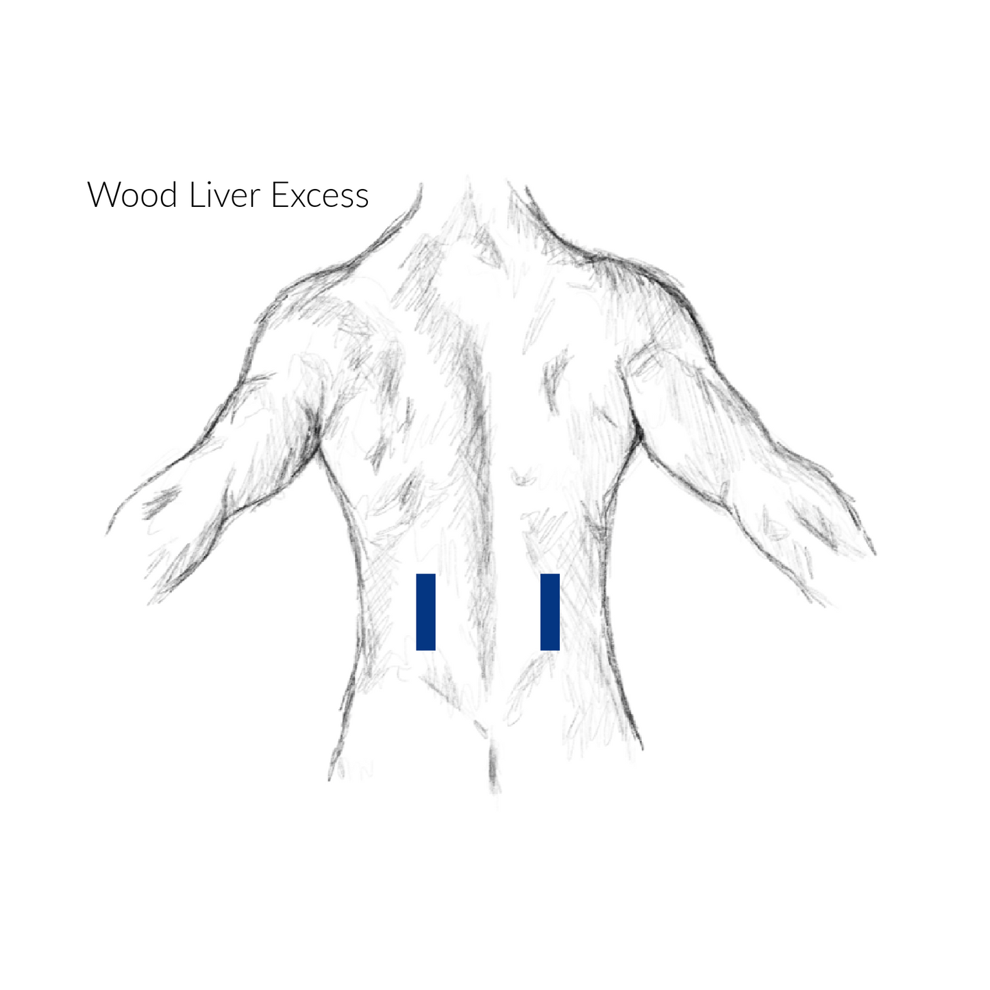 Wood Liver Excess Acupressure Points